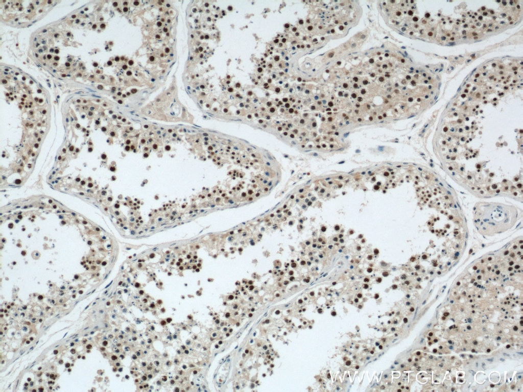 Immunohistochemistry (IHC) staining of human testis tissue using CDK8 Polyclonal antibody (22067-1-AP)