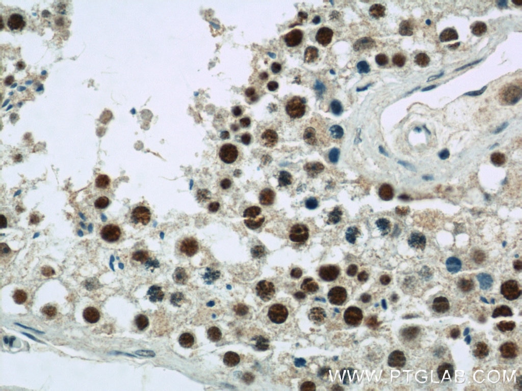 Immunohistochemistry (IHC) staining of human testis tissue using CDK8 Polyclonal antibody (22067-1-AP)