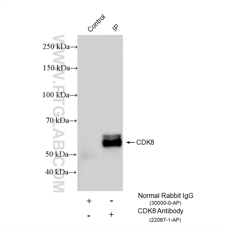 IP experiment of HEK-293 using 22067-1-AP Immunoprecipitation (IP) experiment of HEK-293 cells using CDK8 Polyclonal antibody (22067-1-AP)