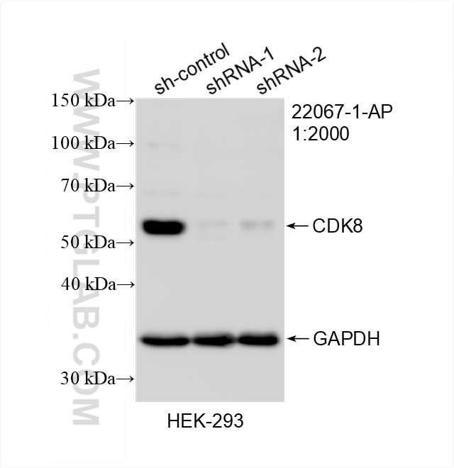 Western Blot (WB) analysis of HEK-293 cells using CDK8 Polyclonal antibody (22067-1-AP)