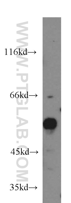 Western Blot (WB) analysis of HeLa cells using CDK8 Polyclonal antibody (22067-1-AP)