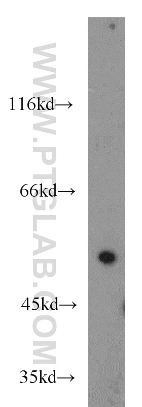 Western Blot (WB) analysis of HEK-293 cells using CDK8 Polyclonal antibody (22067-1-AP)