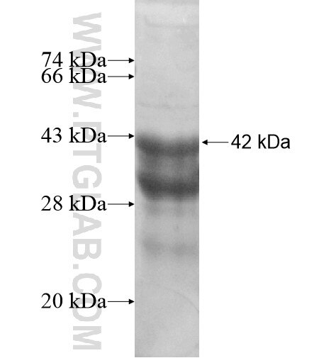 CDK8 fusion protein Ag15606 SDS-PAGE