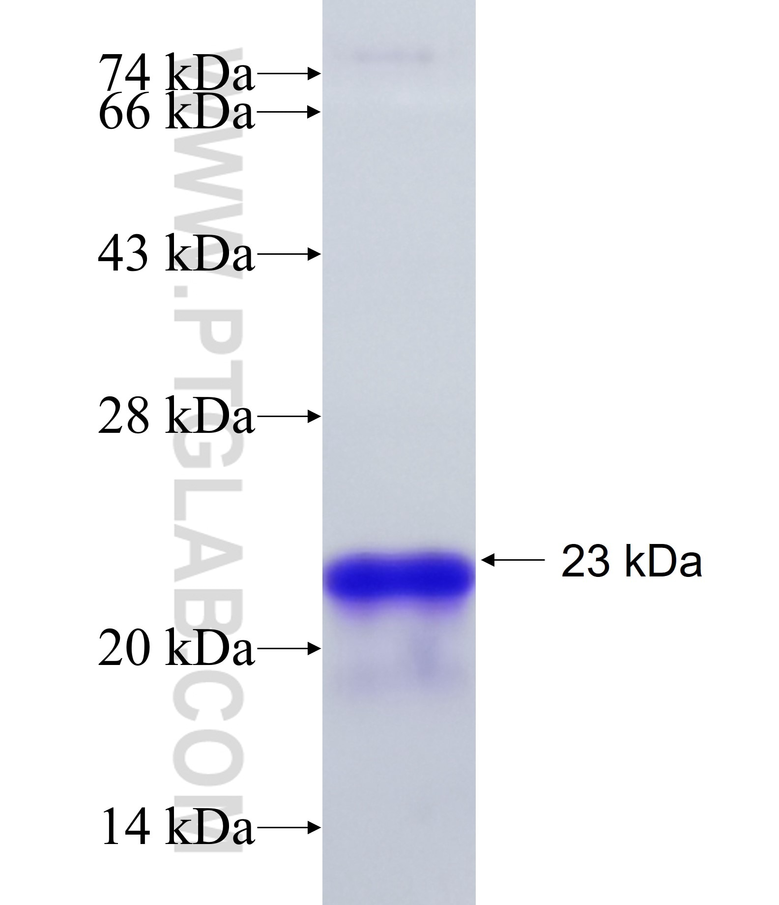 CDK8 fusion protein Ag17148 SDS-PAGE