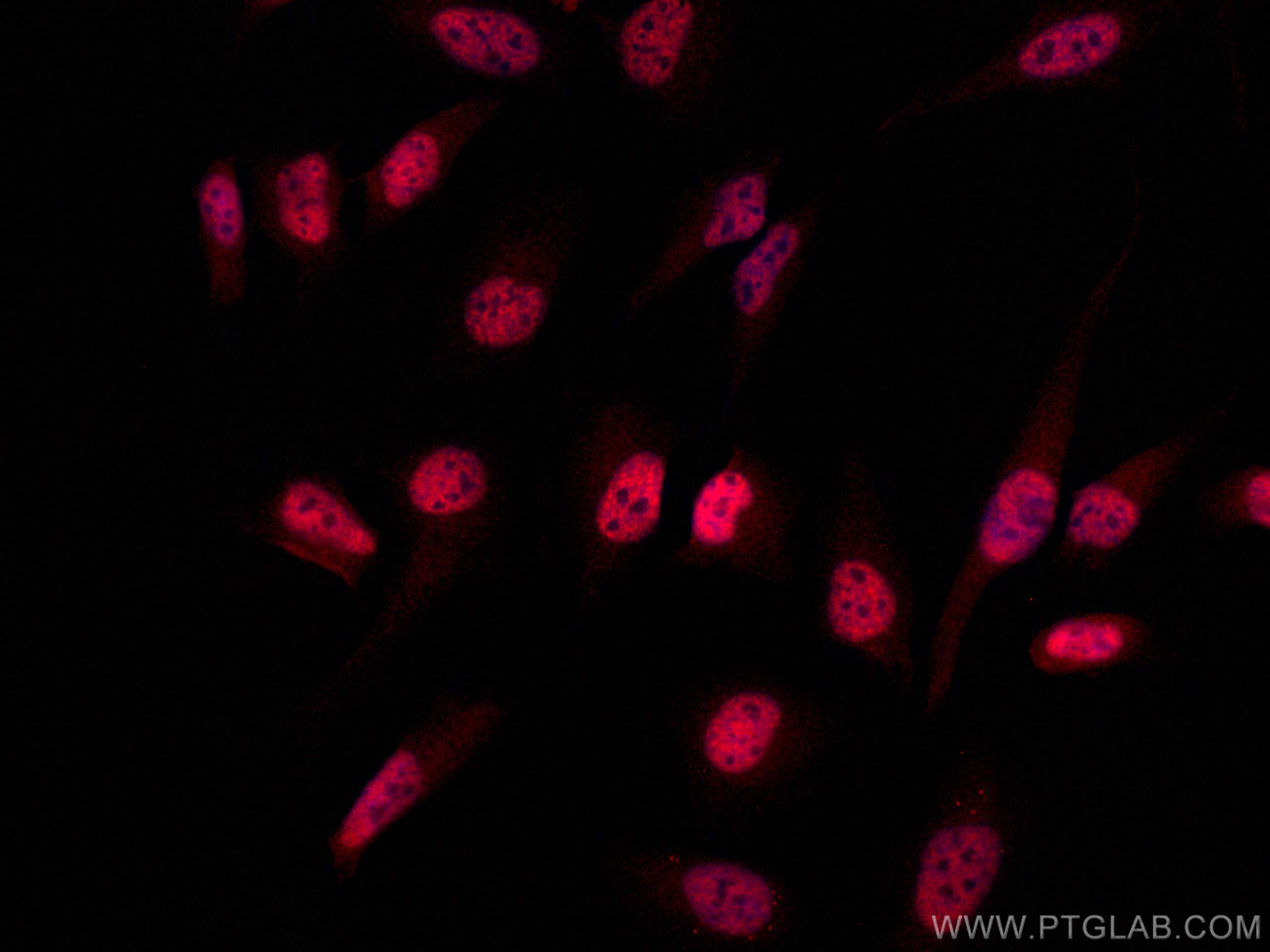 Immunofluorescence (IF) / fluorescent staining of HeLa cells using CDK9 Polyclonal antibody (11705-1-AP)