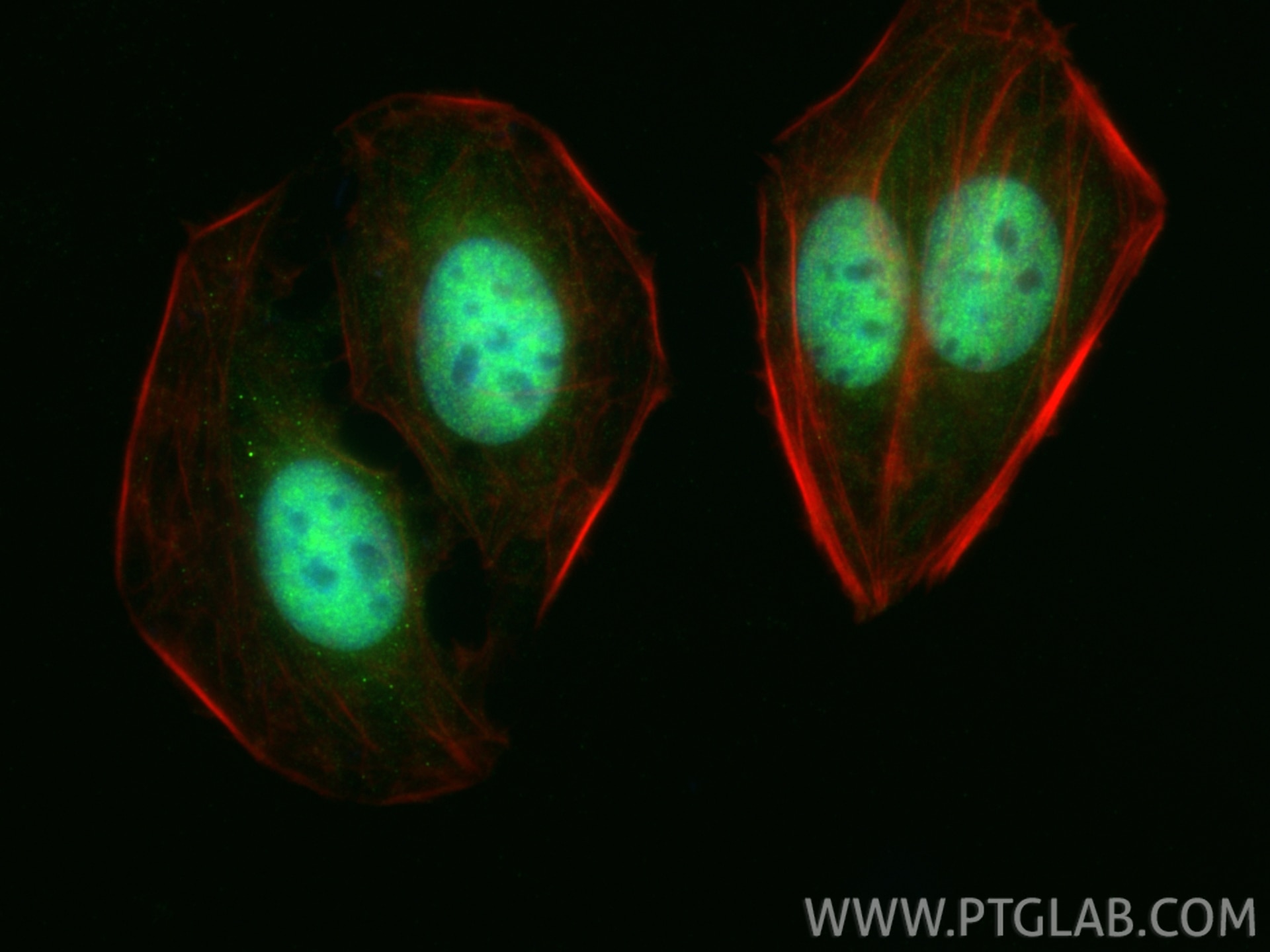 Immunofluorescence (IF) / fluorescent staining of U2OS cells using CDK9 Polyclonal antibody (11705-1-AP)
