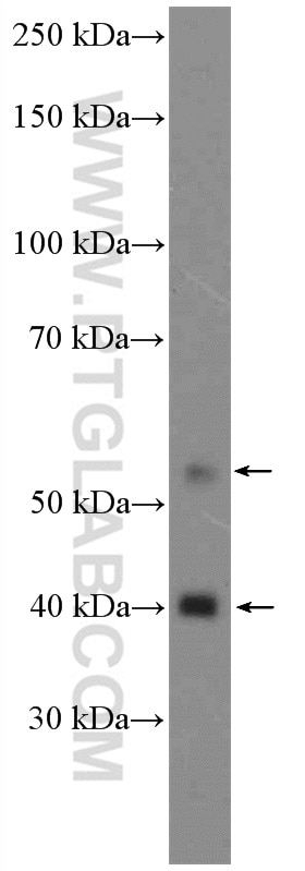 Western Blot (WB) analysis of Jurkat cells using CDK9 Polyclonal antibody (11705-1-AP)