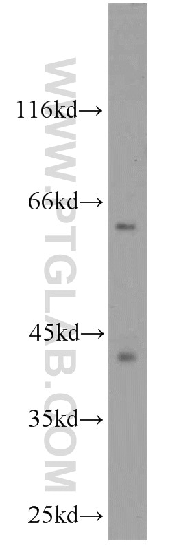 CDK9 Polyclonal antibody