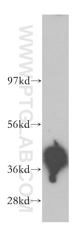 WB analysis of human placenta using 11705-1-AP