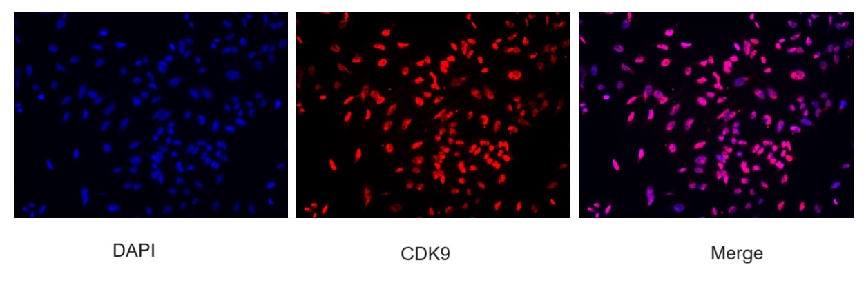 Immunofluorescence (IF) / fluorescent staining of HeLa cells using CDK9 Monoclonal antibody (67256-1-Ig)