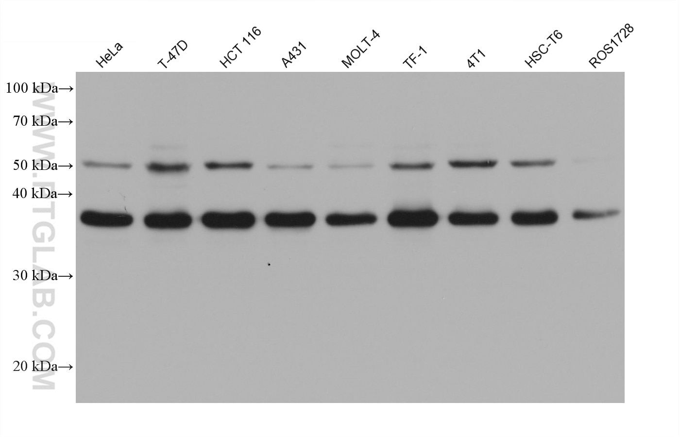 WB analysis using 67256-1-Ig