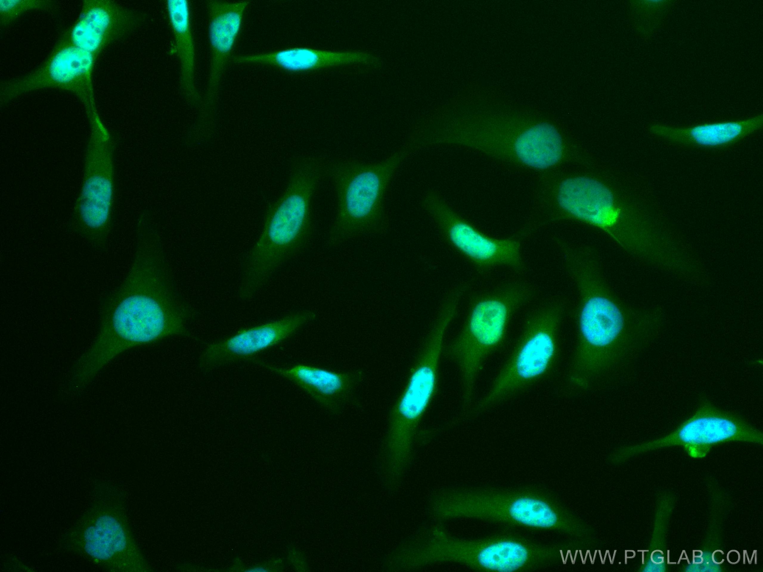 Immunofluorescence (IF) / fluorescent staining of HeLa cells using CoraLite® Plus 488-conjugated CDK9 Polyclonal anti (CL488-11705)