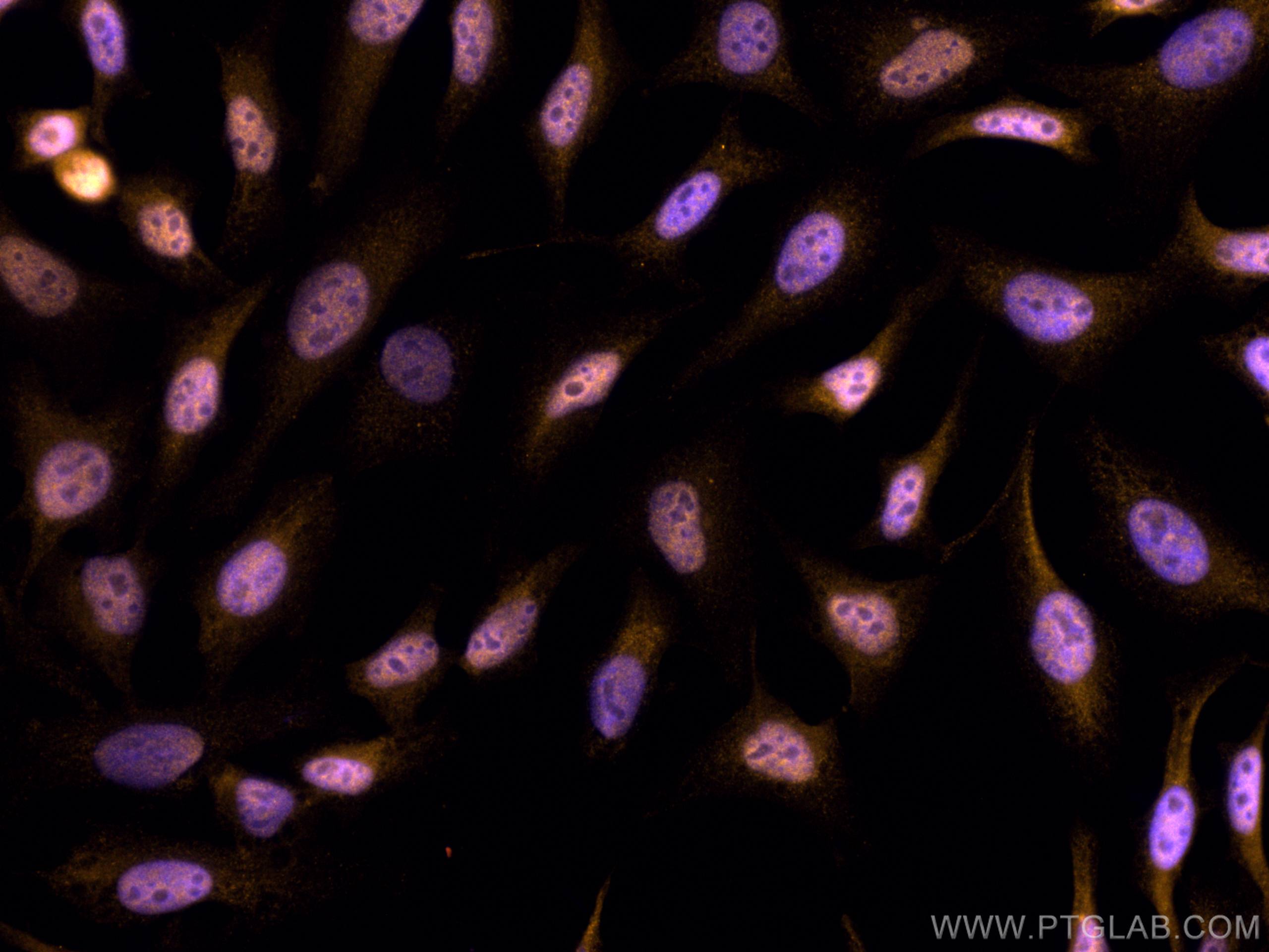 Immunofluorescence (IF) / fluorescent staining of HeLa cells using CoraLite®555-conjugated CDK9 Polyclonal antibody (CL555-11705)