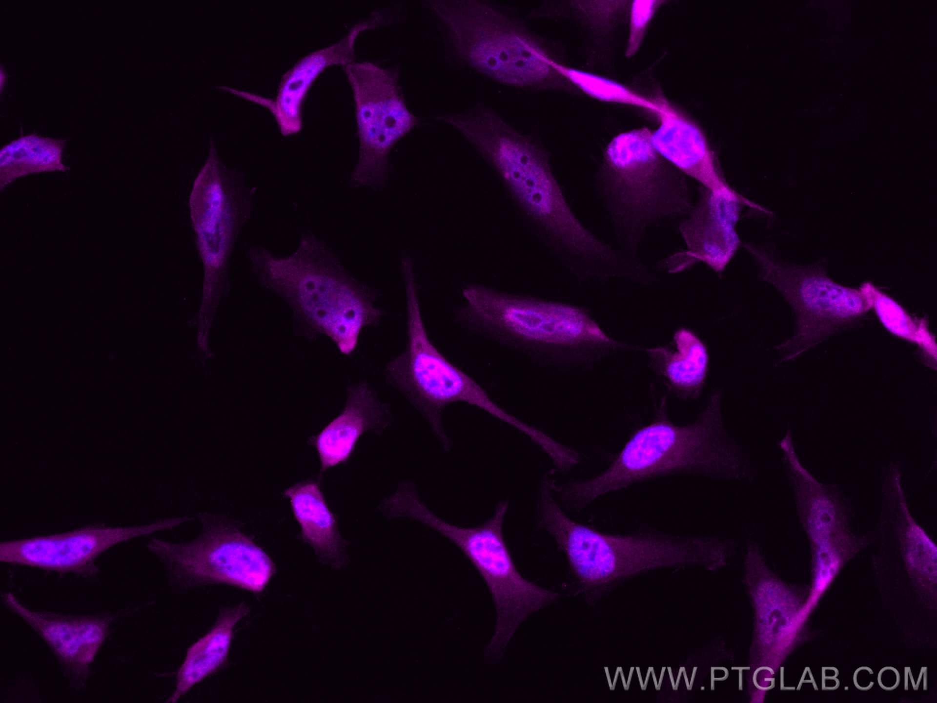Immunofluorescence (IF) / fluorescent staining of HeLa cells using CoraLite® Plus 647-conjugated CDK9 Polyclonal anti (CL647-11705)