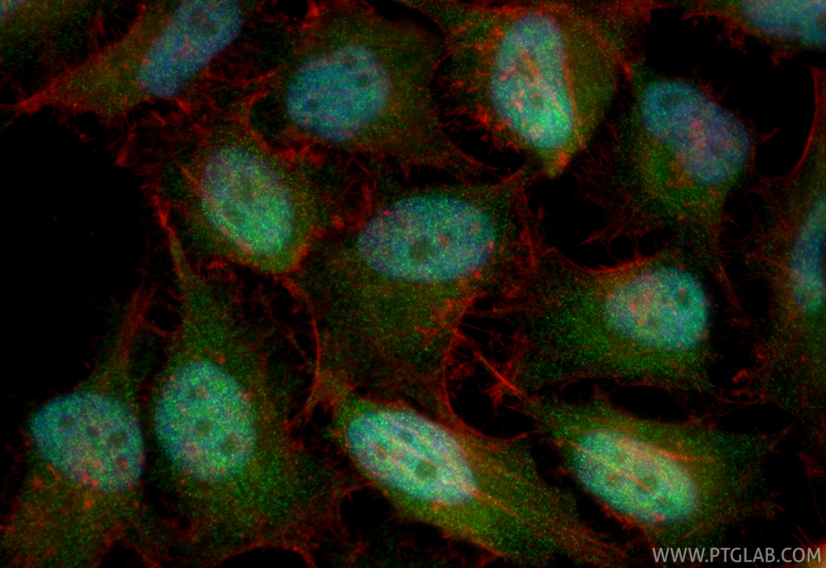 Immunofluorescent analysis of (4% PFA) fixed HeLa cells using CDK9 antibody (RMX00056) at dilution of 1:1100 and CoraLite®488-Conjugated Goat Anti-Rabbit IgG(H+L) (SA00013-2), CL594-phalloidin (red). Immunofluorescence (IF) / fluorescent staining of HeLa cells using Multi-rAb® CDK9 Multi-Recombinant antibody (RMX00056)