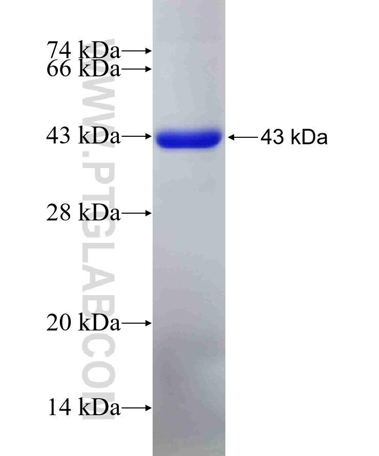 CDK9 fusion protein Ag29178 SDS-PAGE