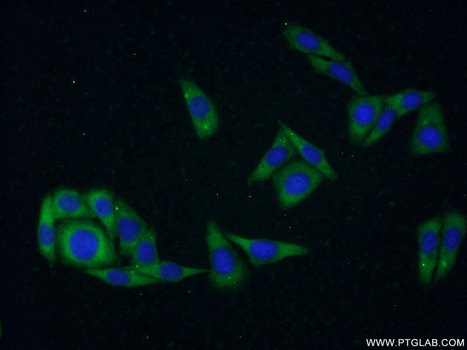 Immunofluorescence (IF) / fluorescent staining of HepG2 cells using CDKAL1 Polyclonal antibody (22988-1-AP)