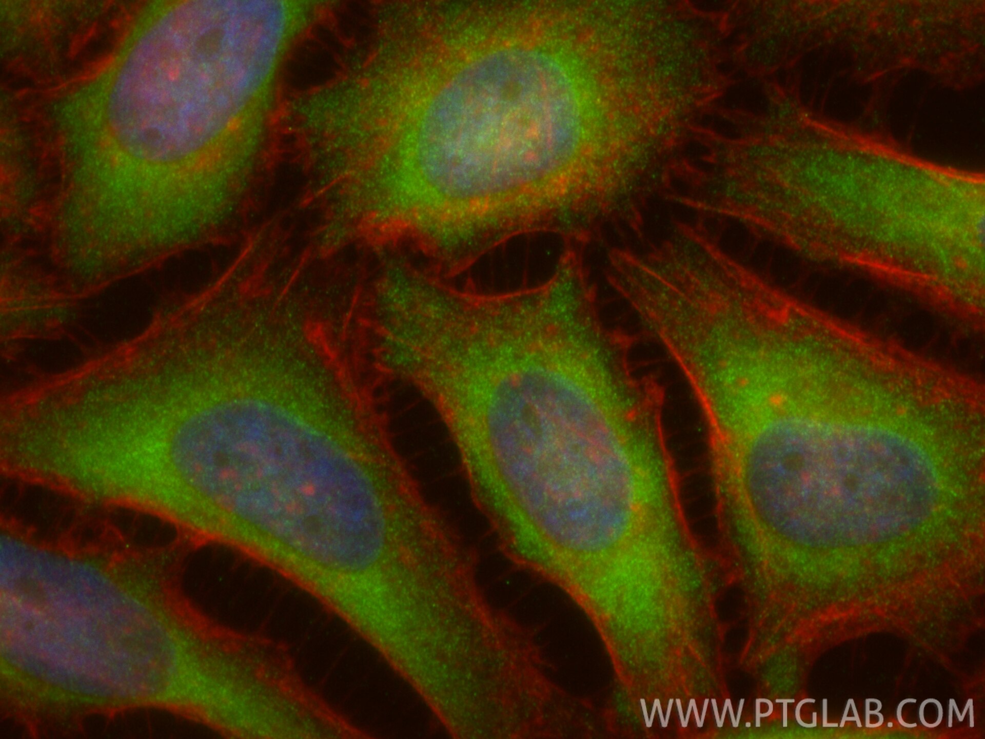 IF Staining of HeLa using 22988-1-AP Immunofluorescence (IF) / fluorescent staining of HeLa cells using CDKAL1 Polyclonal antibody (22988-1-AP)