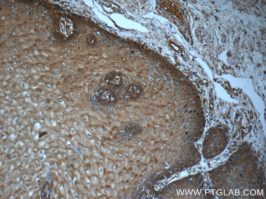Immunohistochemistry (IHC) staining of human oesophagus tissue using CDKAL1 Polyclonal antibody (22988-1-AP)