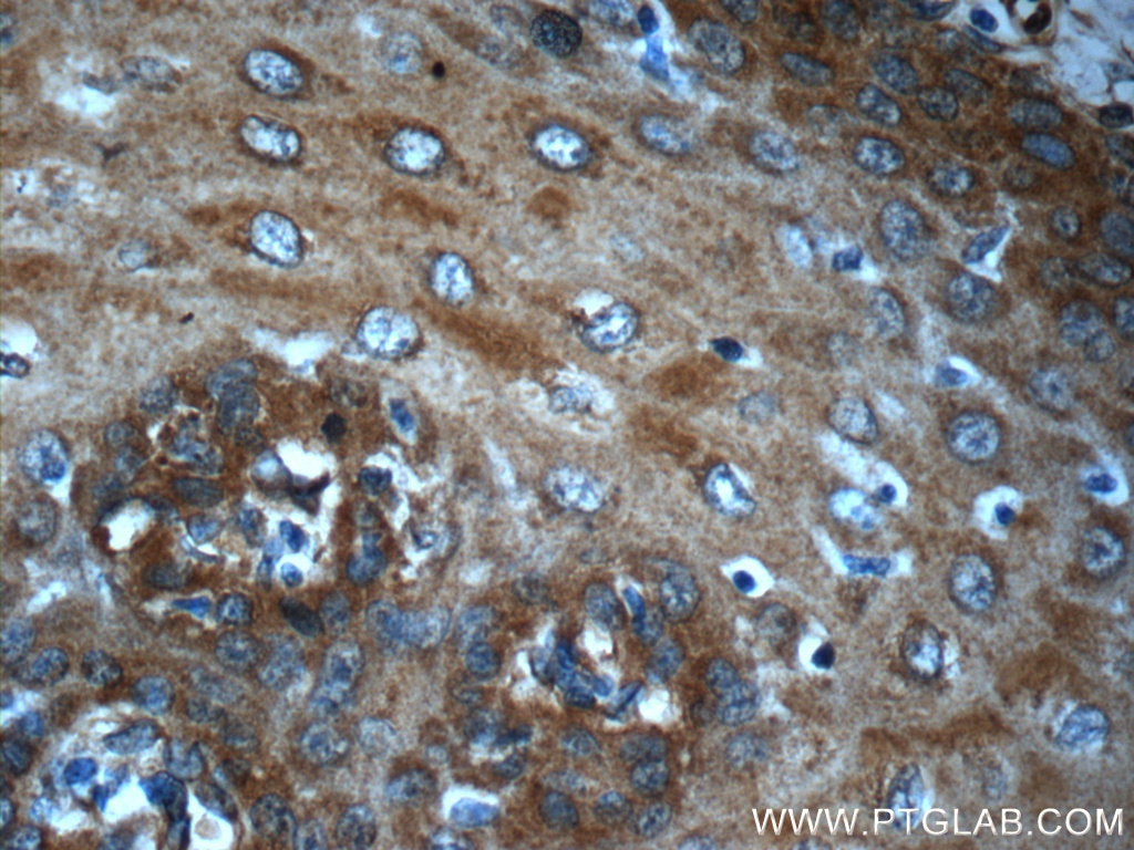 Immunohistochemistry (IHC) staining of human oesophagus tissue using CDKAL1 Polyclonal antibody (22988-1-AP)