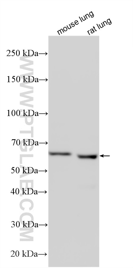 Western Blot (WB) analysis of various lysates using CDKAL1 Polyclonal antibody (22988-1-AP)