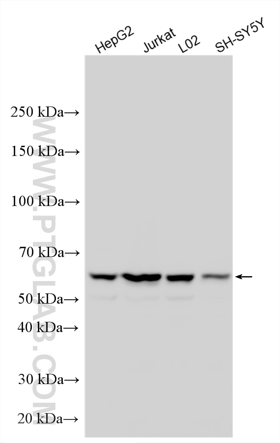 Western Blot (WB) analysis of various lysates using CDKAL1 Polyclonal antibody (22988-1-AP)