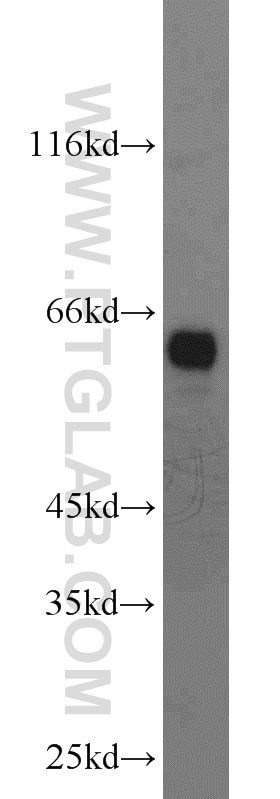Western Blot (WB) analysis of Jurkat cells using CDKAL1 Polyclonal antibody (22988-1-AP)