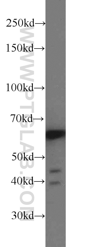 Western Blot (WB) analysis of HepG2 cells using CDKAL1 Polyclonal antibody (22988-1-AP)