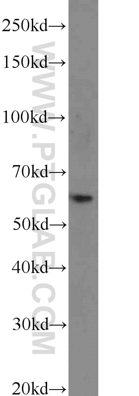 Western Blot (WB) analysis of mouse lung tissue using CDKAL1 Polyclonal antibody (22988-1-AP)