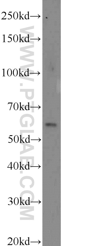 WB analysis of mouse lung using 22988-1-AP