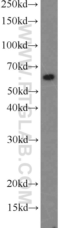 Western Blot (WB) analysis of HT-1080 cells using CDKAL1 Polyclonal antibody (22988-1-AP)