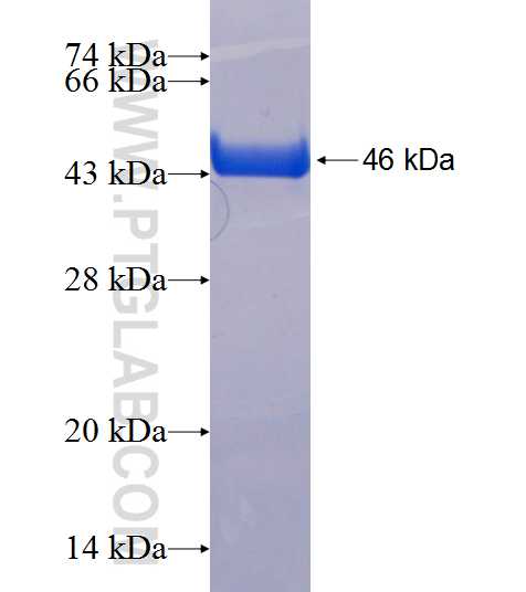 CDKAL1 fusion protein Ag19060 SDS-PAGE