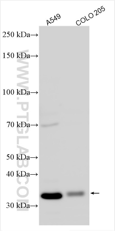 Western Blot (WB) analysis of various lysates using CDKL1 Polyclonal antibody (25702-1-AP)