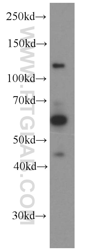 Western Blot (WB) analysis of HeLa cells using NKIAMRE Polyclonal antibody (13888-1-AP)