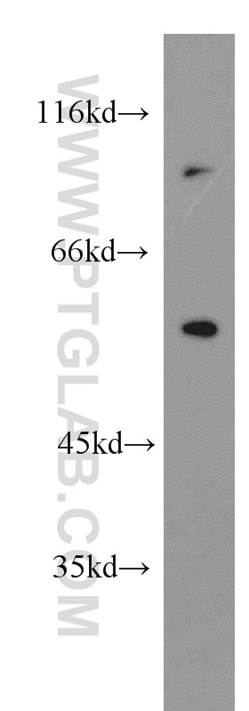 Western Blot (WB) analysis of HeLa cells using NKIAMRE Polyclonal antibody (13888-1-AP)