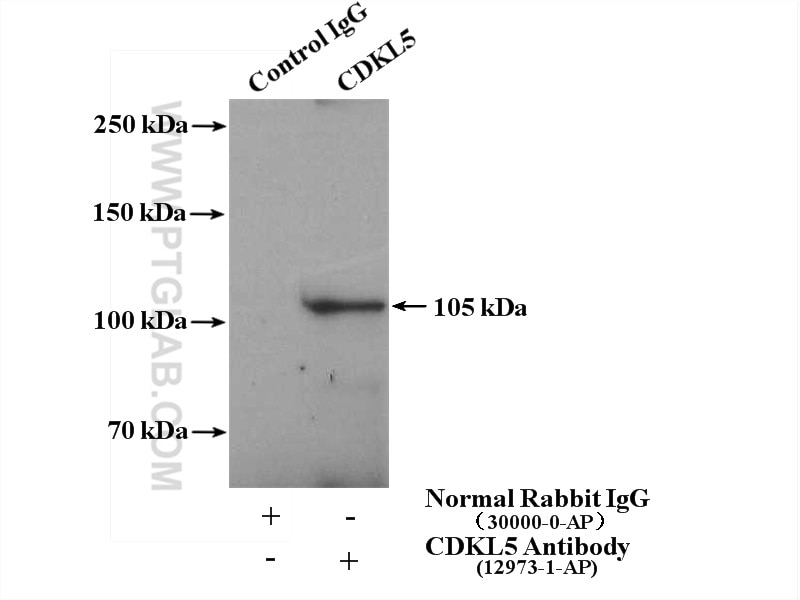 Immunoprecipitation (IP) experiment of mouse brain tissue using CDKL5 Polyclonal antibody (12973-1-AP)
