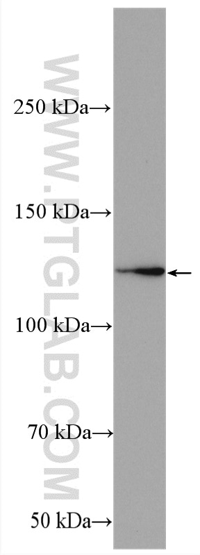 Western Blot (WB) analysis of HepG2 cells using CDKL5 Polyclonal antibody (12973-1-AP)