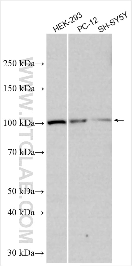 Western Blot (WB) analysis of various lysates using CDKL5 Polyclonal antibody (12973-1-AP)