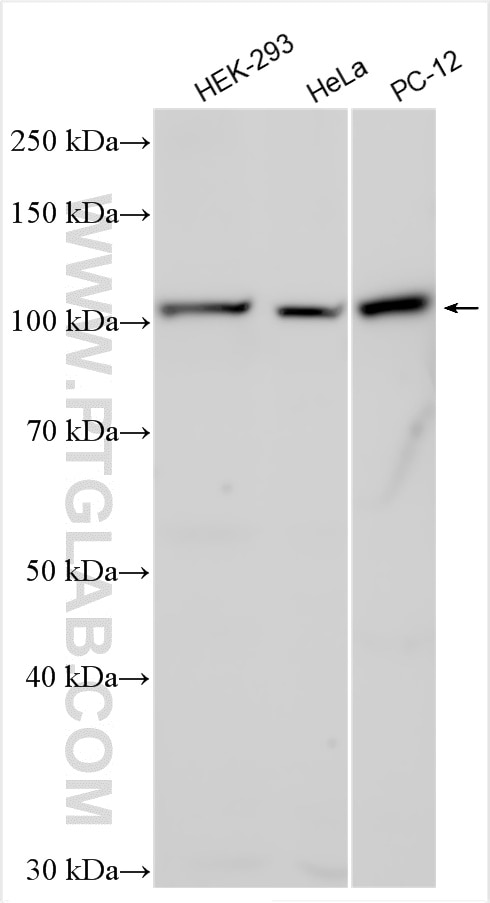 Western Blot (WB) analysis of various lysates using CDKL5 Polyclonal antibody (12973-1-AP)