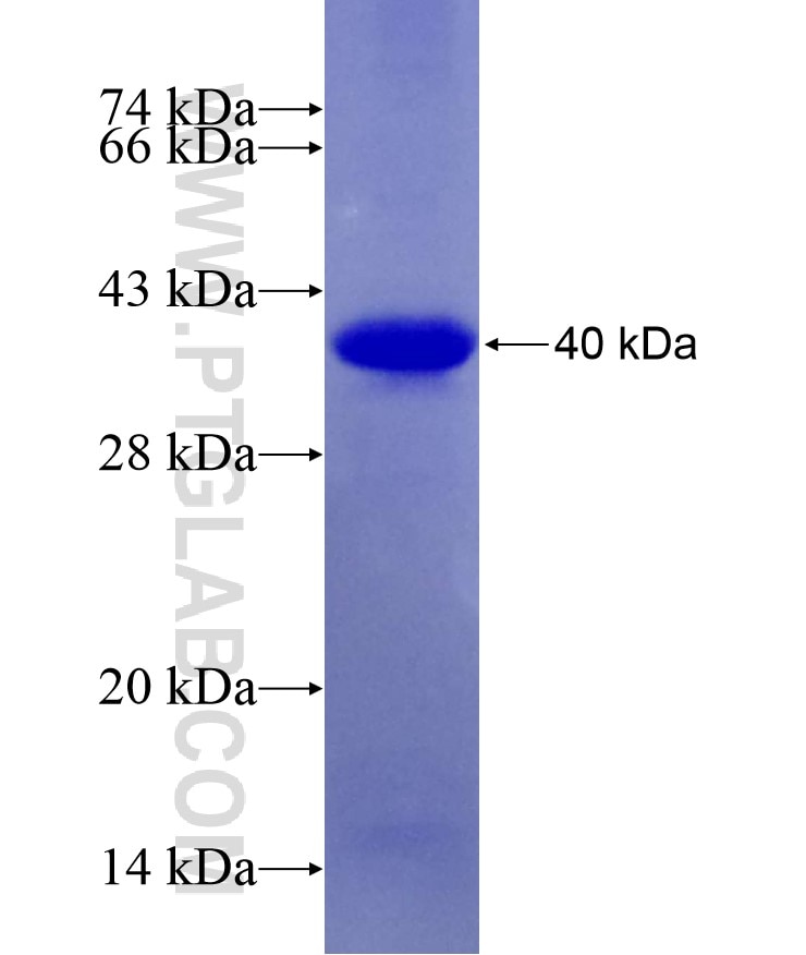 CDKL5 fusion protein Ag29091 SDS-PAGE