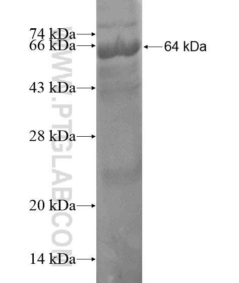 CDKN1C fusion protein Ag19849 SDS-PAGE