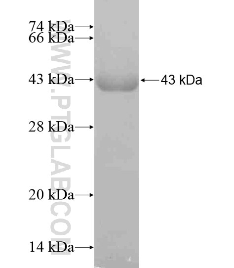 CDKN1C fusion protein Ag19927 SDS-PAGE