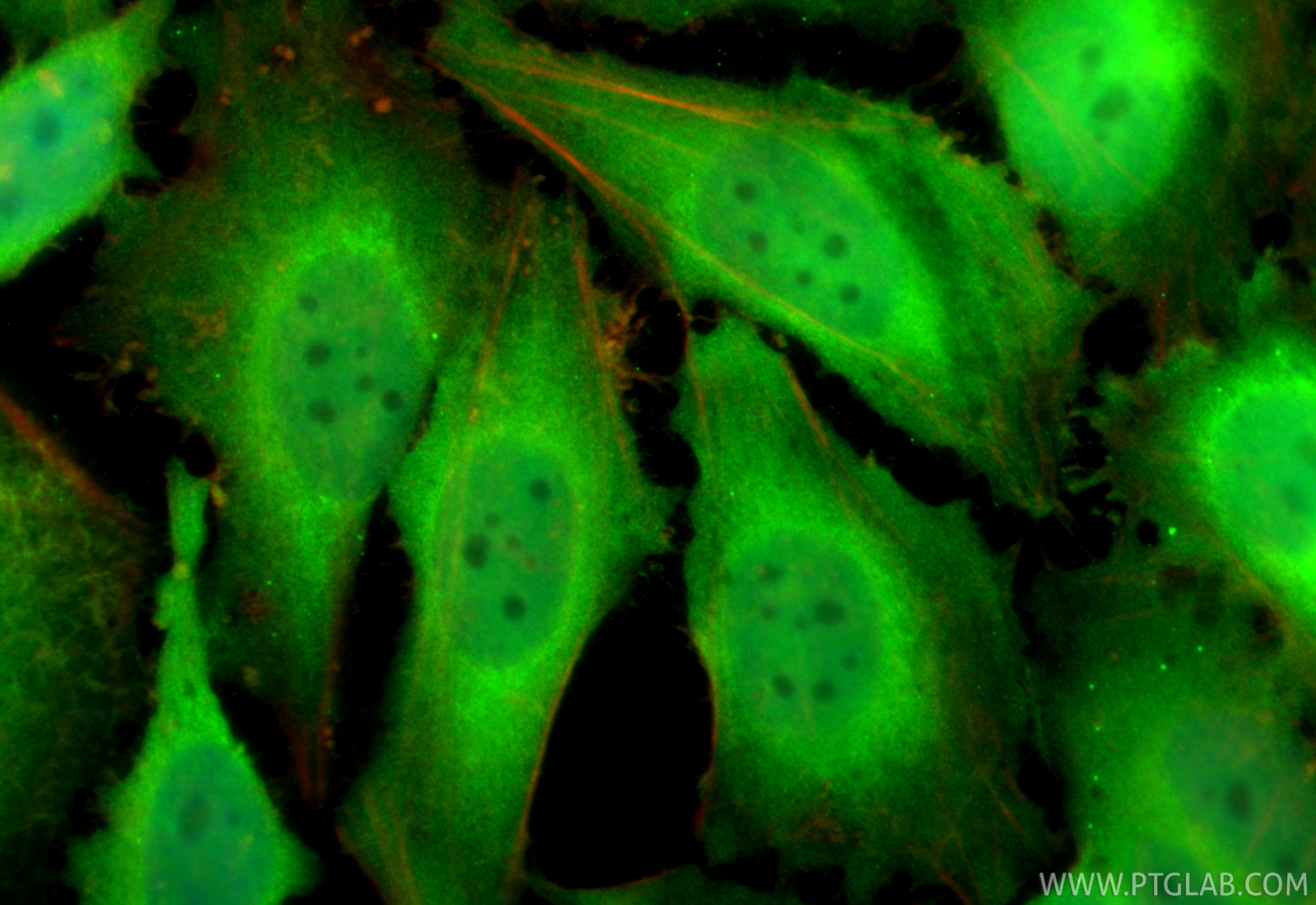 IF Staining of HeLa using RMX00038 Immunofluorescence (IF) / fluorescent staining of HeLa cells using Multi-rAb® CDKN2A/P16-INK4A Multi-Recombinant anti (RMX00038)