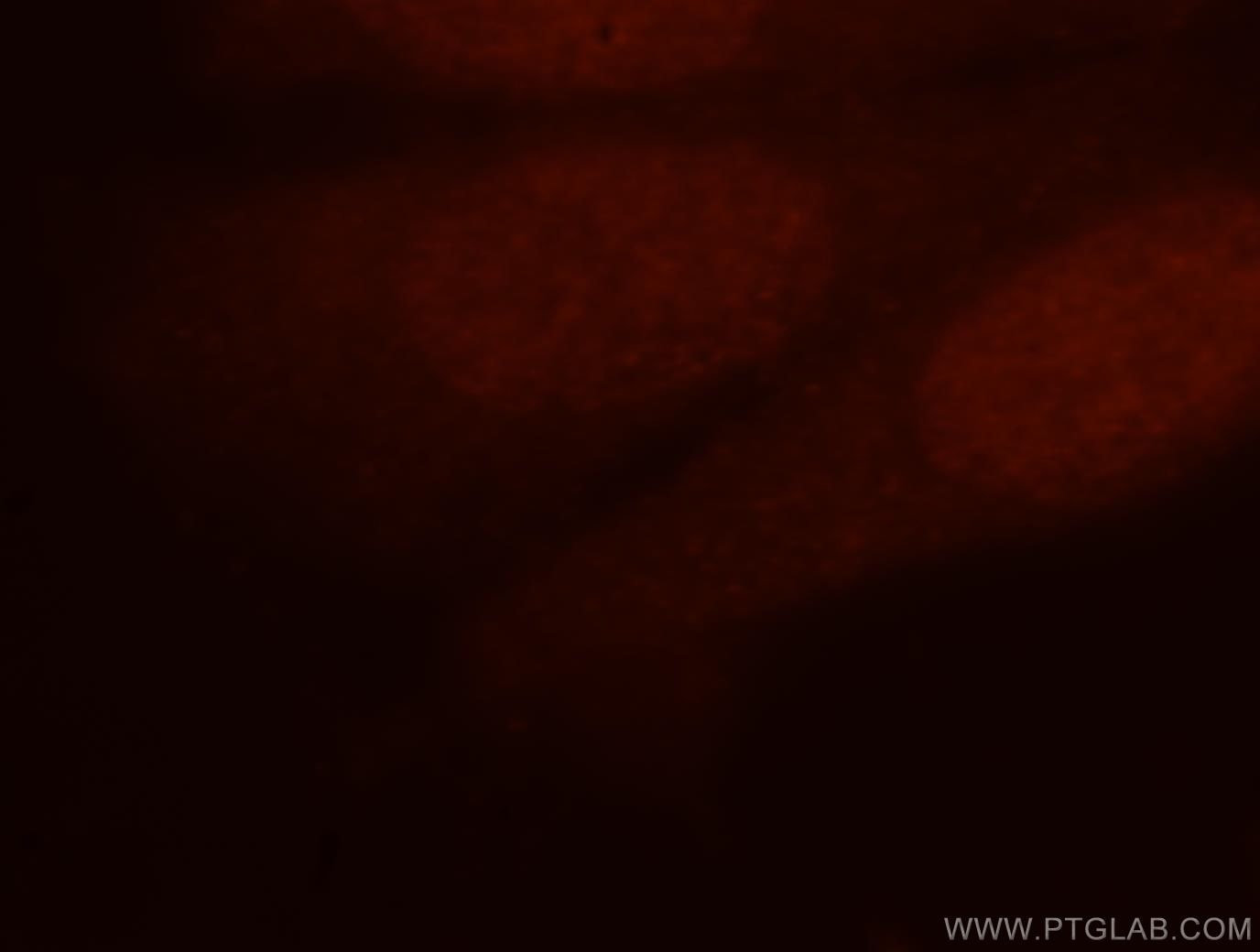 Immunofluorescence (IF) / fluorescent staining of HepG2 cells using CDKN2AIP Polyclonal antibody (16615-1-AP)