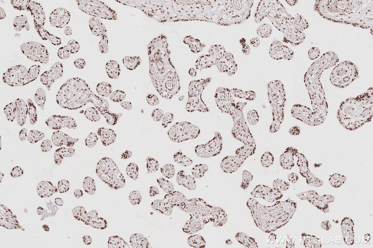 Immunohistochemistry (IHC) staining of human placenta tissue using CDKN2AIP Polyclonal antibody (16615-1-AP)