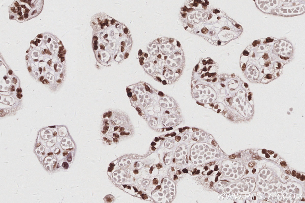 Immunohistochemistry (IHC) staining of human placenta tissue using CDKN2AIP Polyclonal antibody (16615-1-AP)
