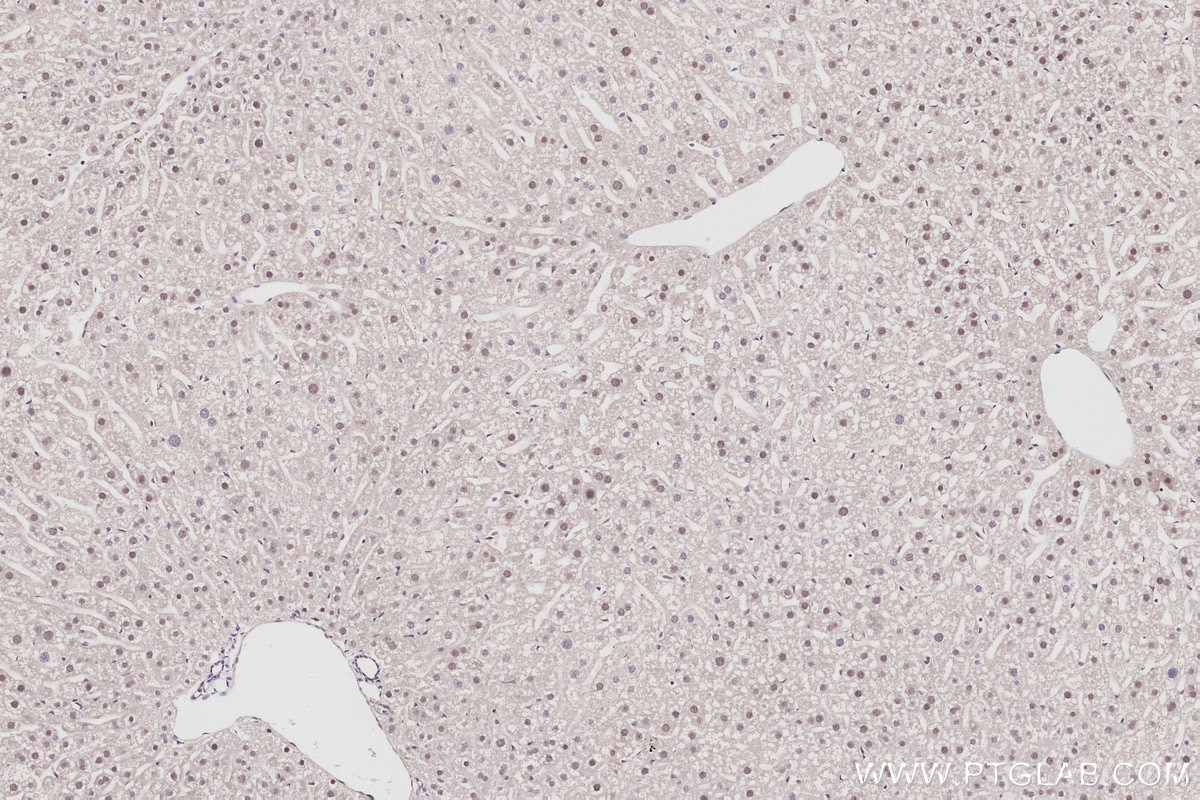 Immunohistochemistry (IHC) staining of mouse liver tissue using CDKN2AIP Polyclonal antibody (16615-1-AP)