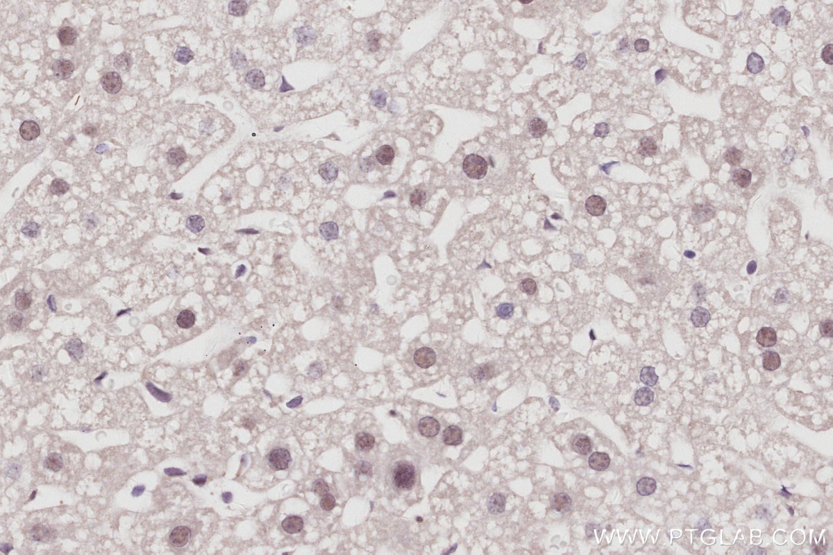 Immunohistochemistry (IHC) staining of mouse liver tissue using CDKN2AIP Polyclonal antibody (16615-1-AP)