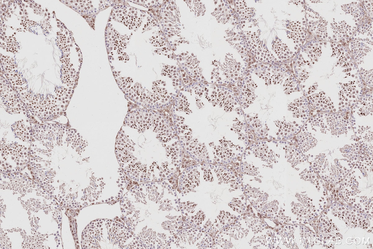 Immunohistochemistry (IHC) staining of mouse testis tissue using CDKN2AIP Polyclonal antibody (16615-1-AP)