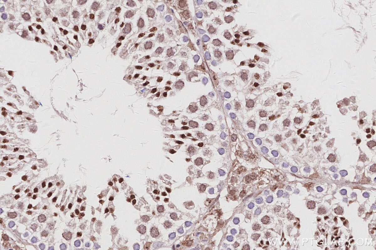 Immunohistochemistry (IHC) staining of mouse testis tissue using CDKN2AIP Polyclonal antibody (16615-1-AP)